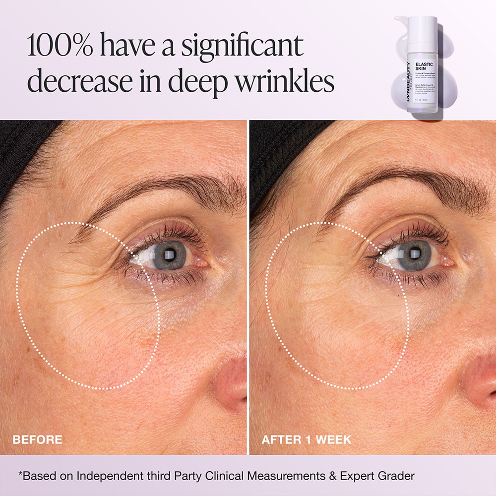 Elastic Skin Refill Set
