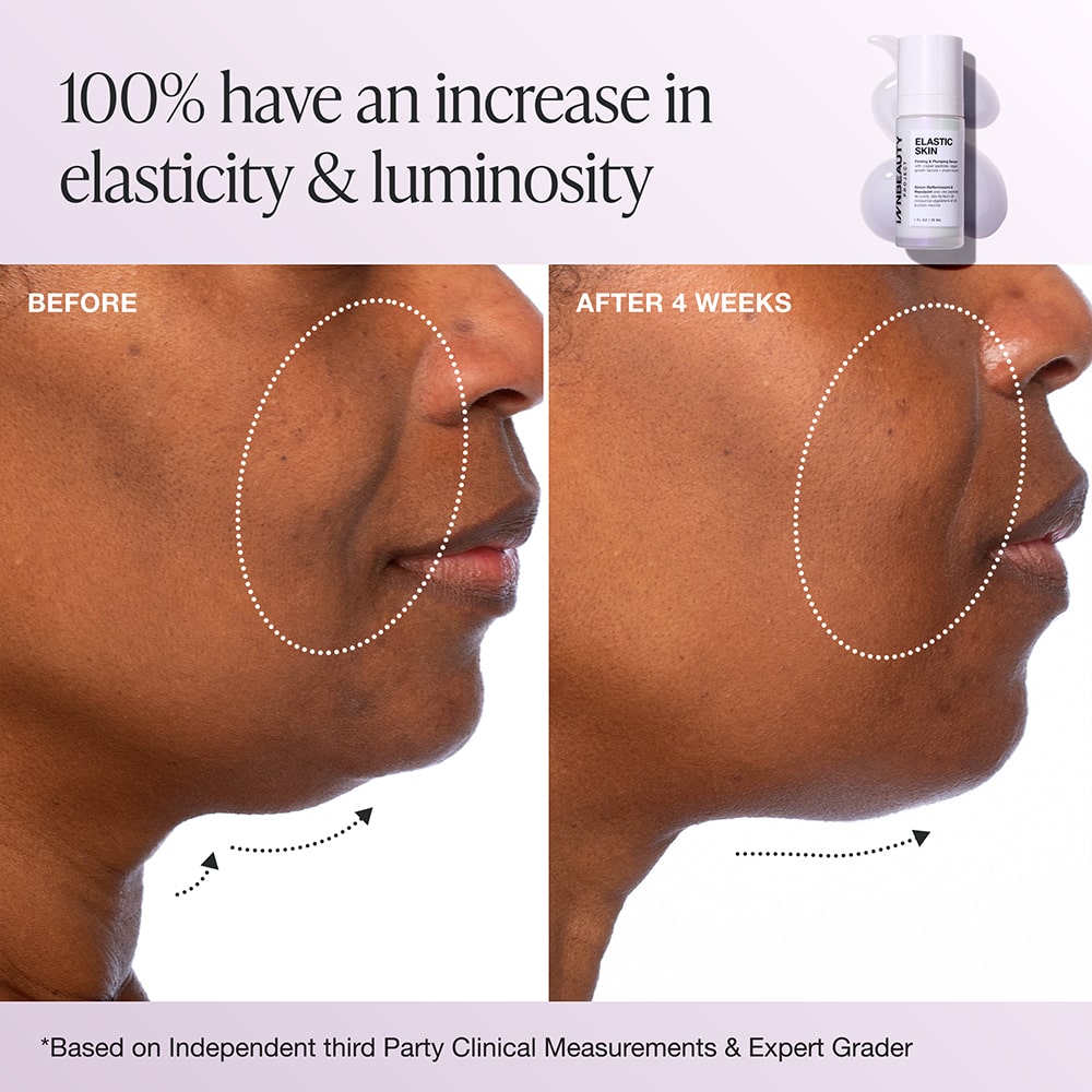 Elastic Skin