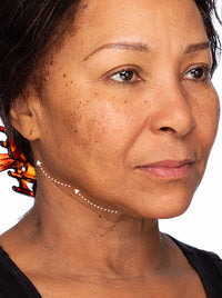 Recharge Gel Cream before and after images