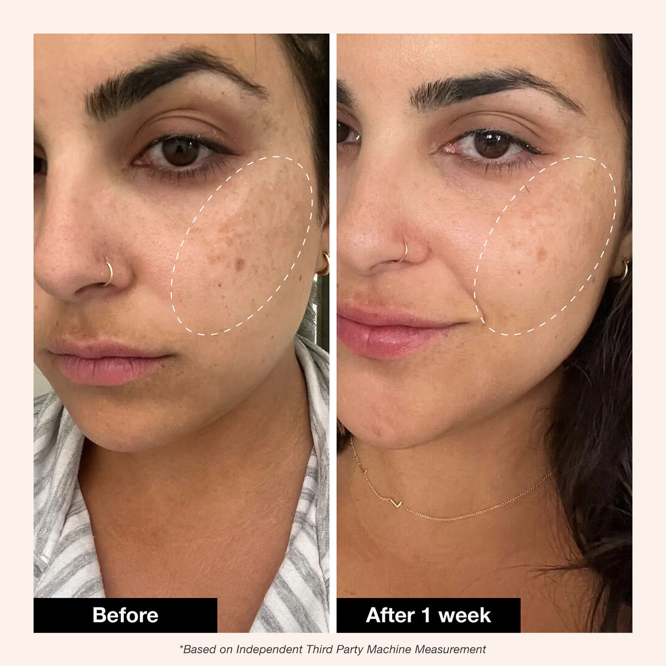 Retinol Remix 1% Retinol