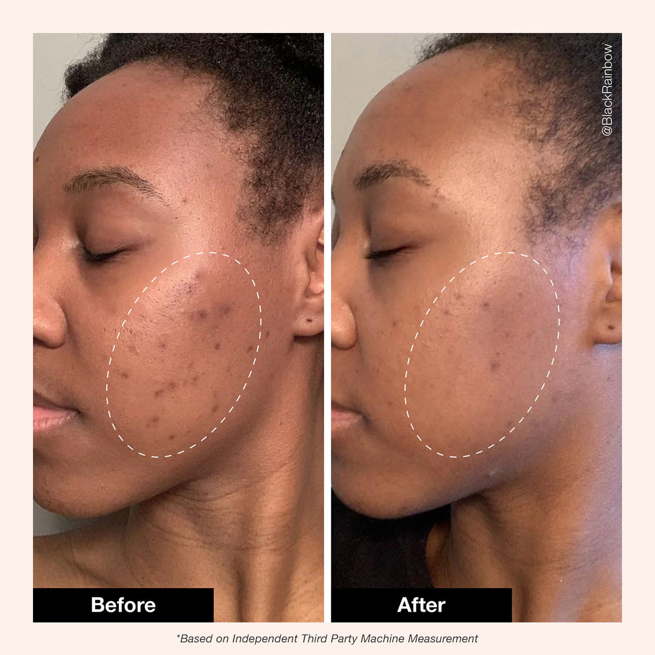 Retinol Remix 1% Retinol