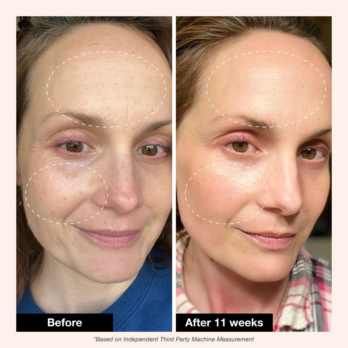 Retinol Remix 1% Retinol