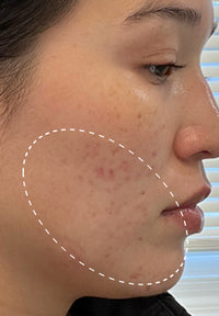 10+10 Daily Moisturizer before and after images