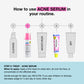 Acne Serum