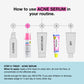 Acne Trio