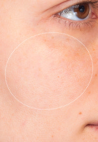 Pore Refine before and after images