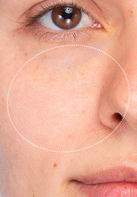 Pore Refine before and after images