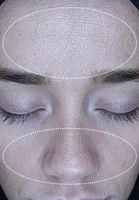 Pore Refine before and after images