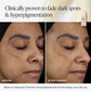 Pro C Serum