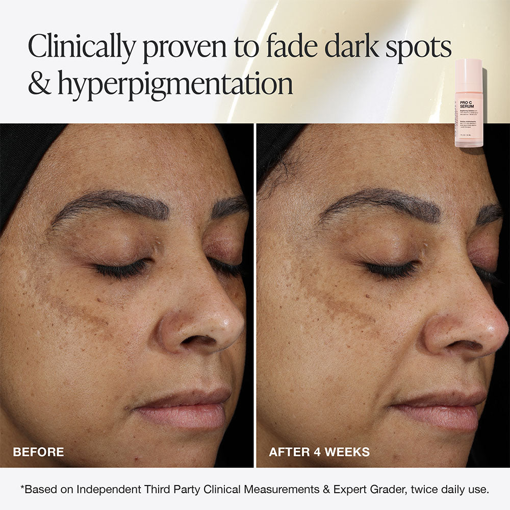 Pro C Serum
