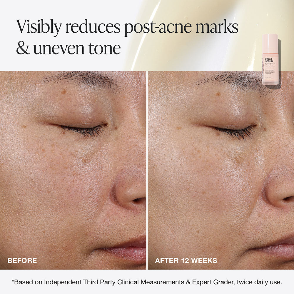 Pro C Serum