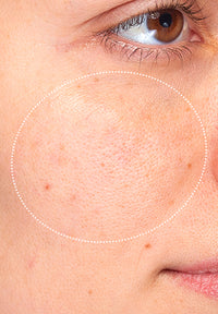 Pore Refine before and after images
