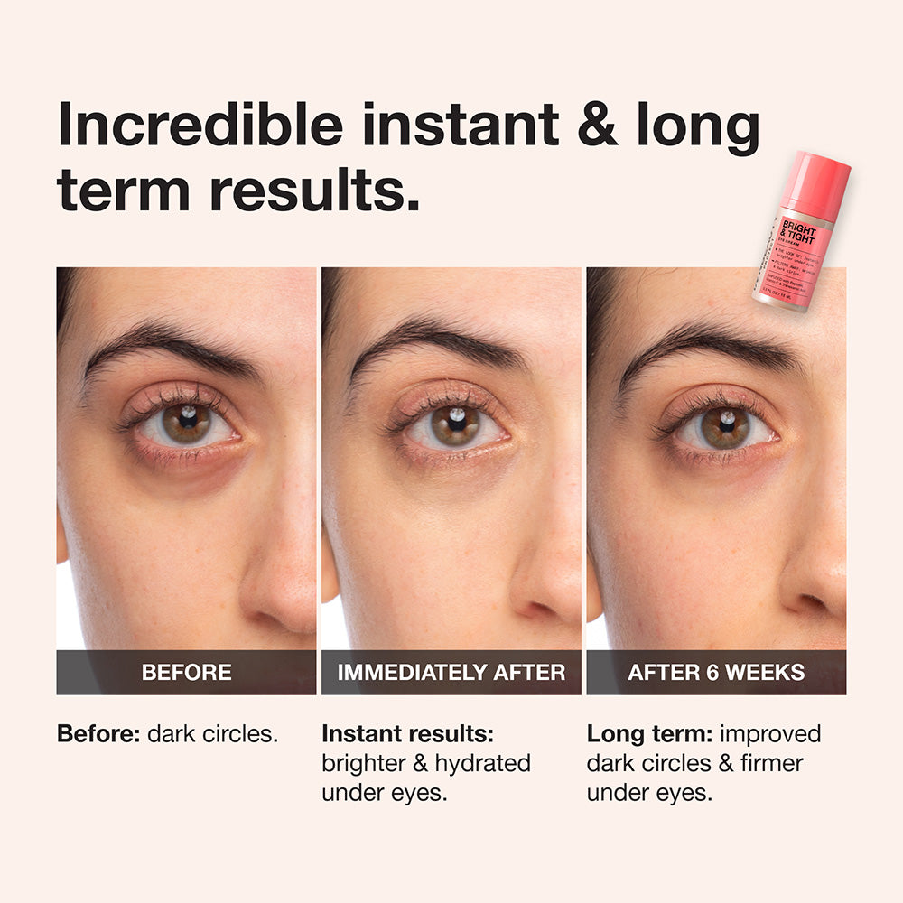 Bright & Tight Eye Cream – INNBEAUTY PROJECT