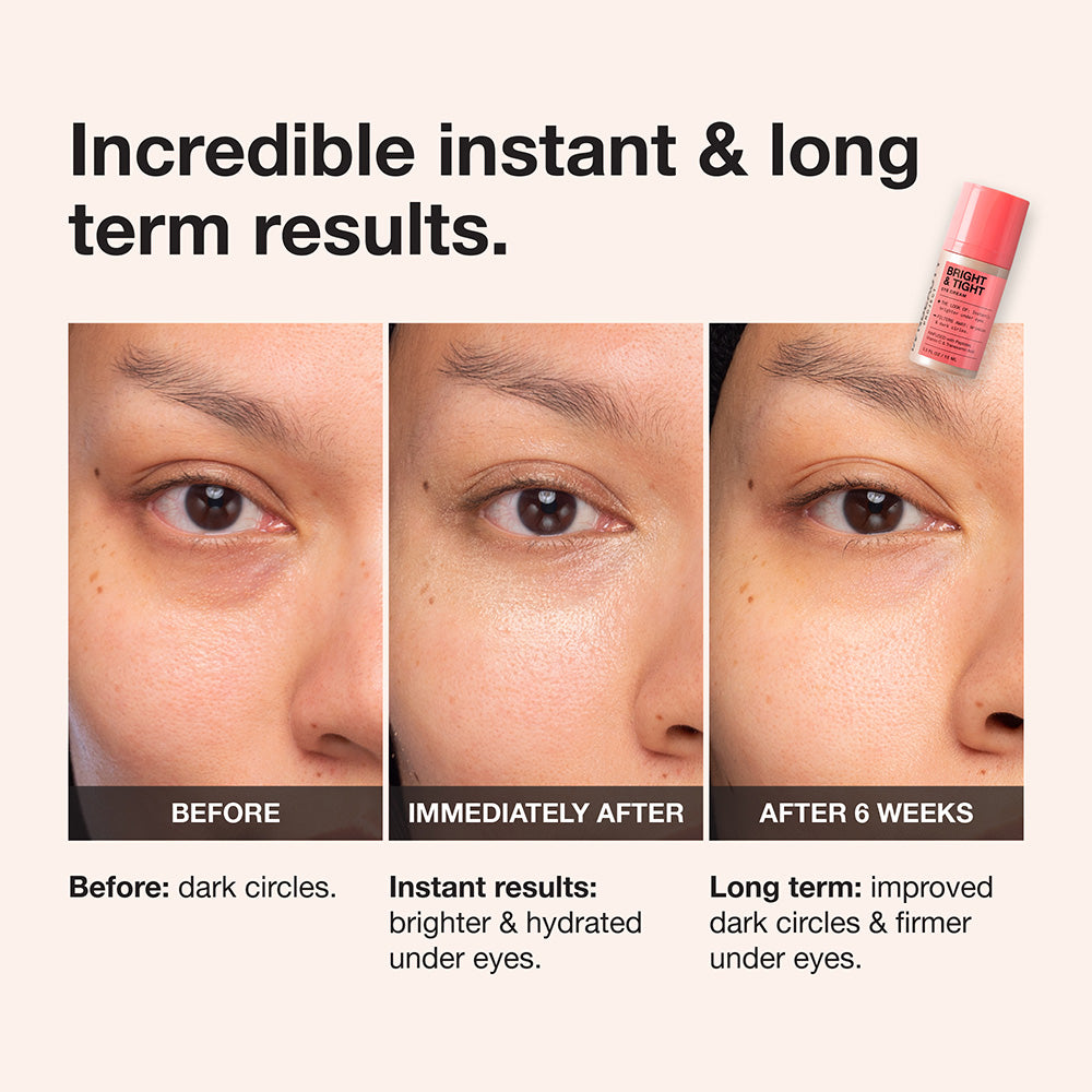 Bright & Tight Eye Cream – INNBEAUTY PROJECT