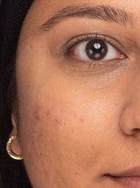 Bright & Tight Eye Cream Travel Size before and after images