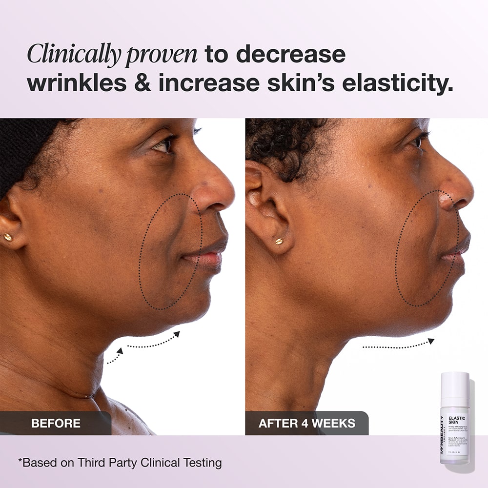 Elastic Skin