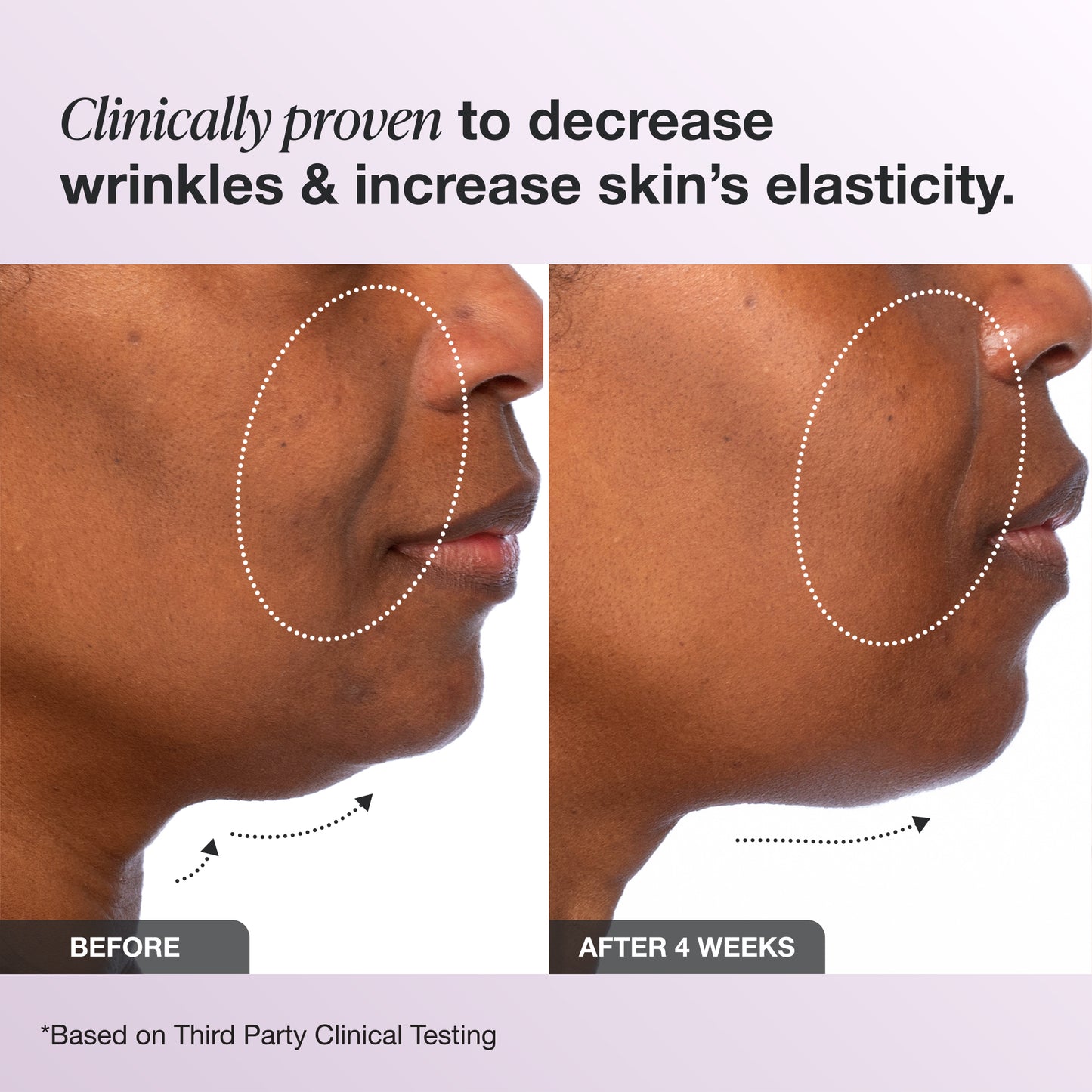 Elastic Skin
