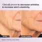Elastic Skin