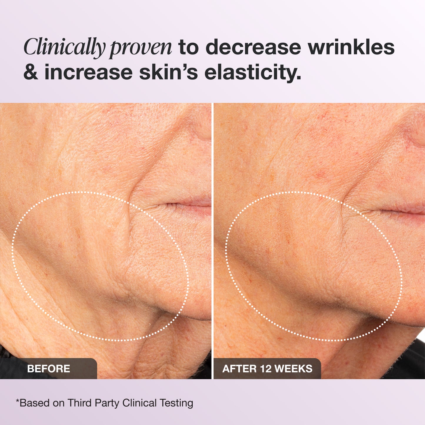 Elastic Skin