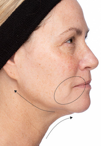 Elastic Skin after