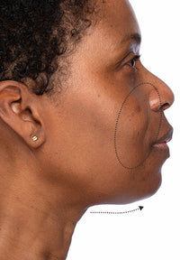 Elastic Skin before and after images