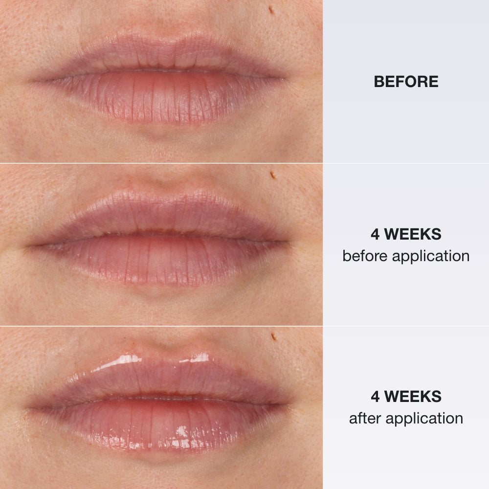 Extreme Lip