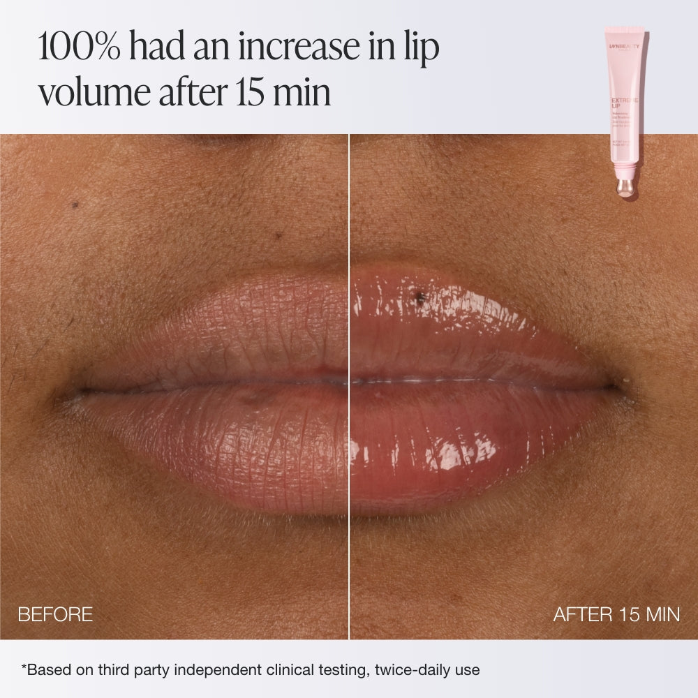 Extreme Lip