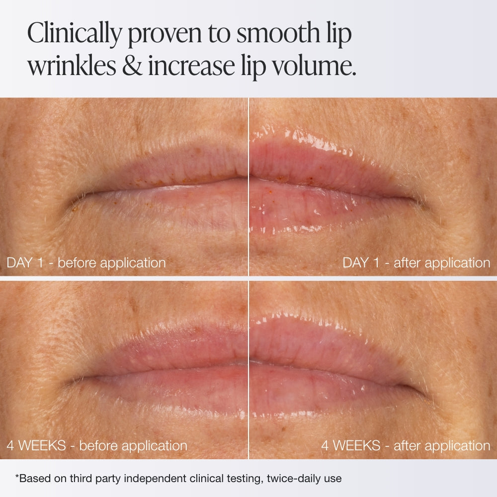 Extreme Lip