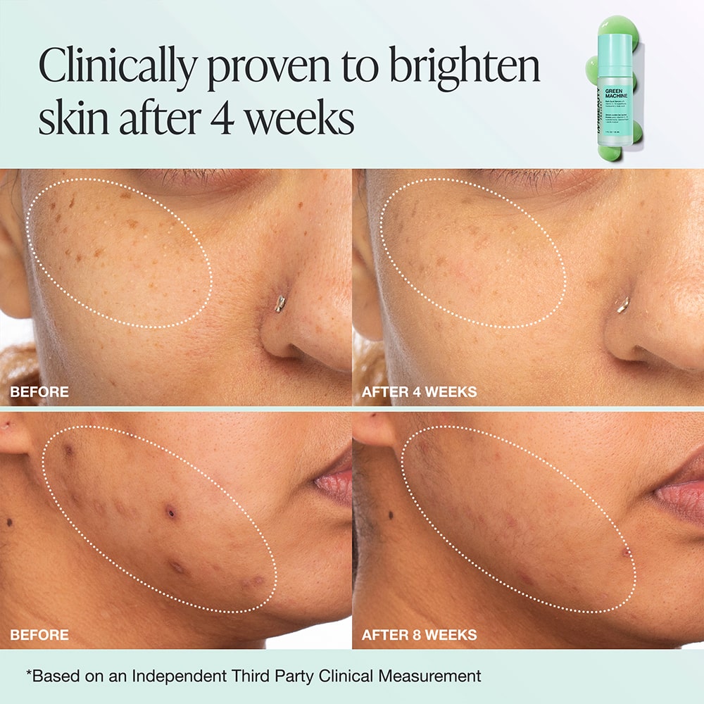 Green Machine Serum