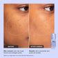 Pore Refine