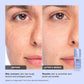 Pore Refine