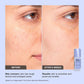 Pore Refine