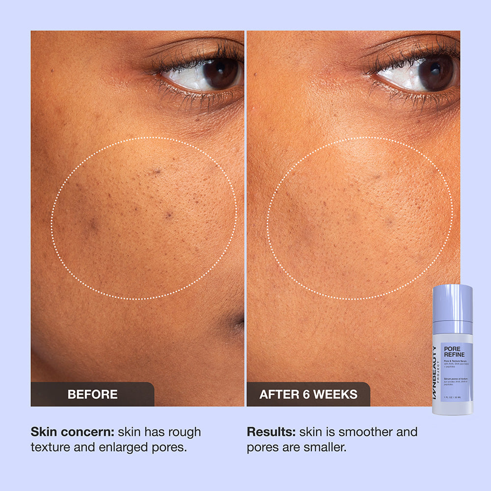 Pore Refine