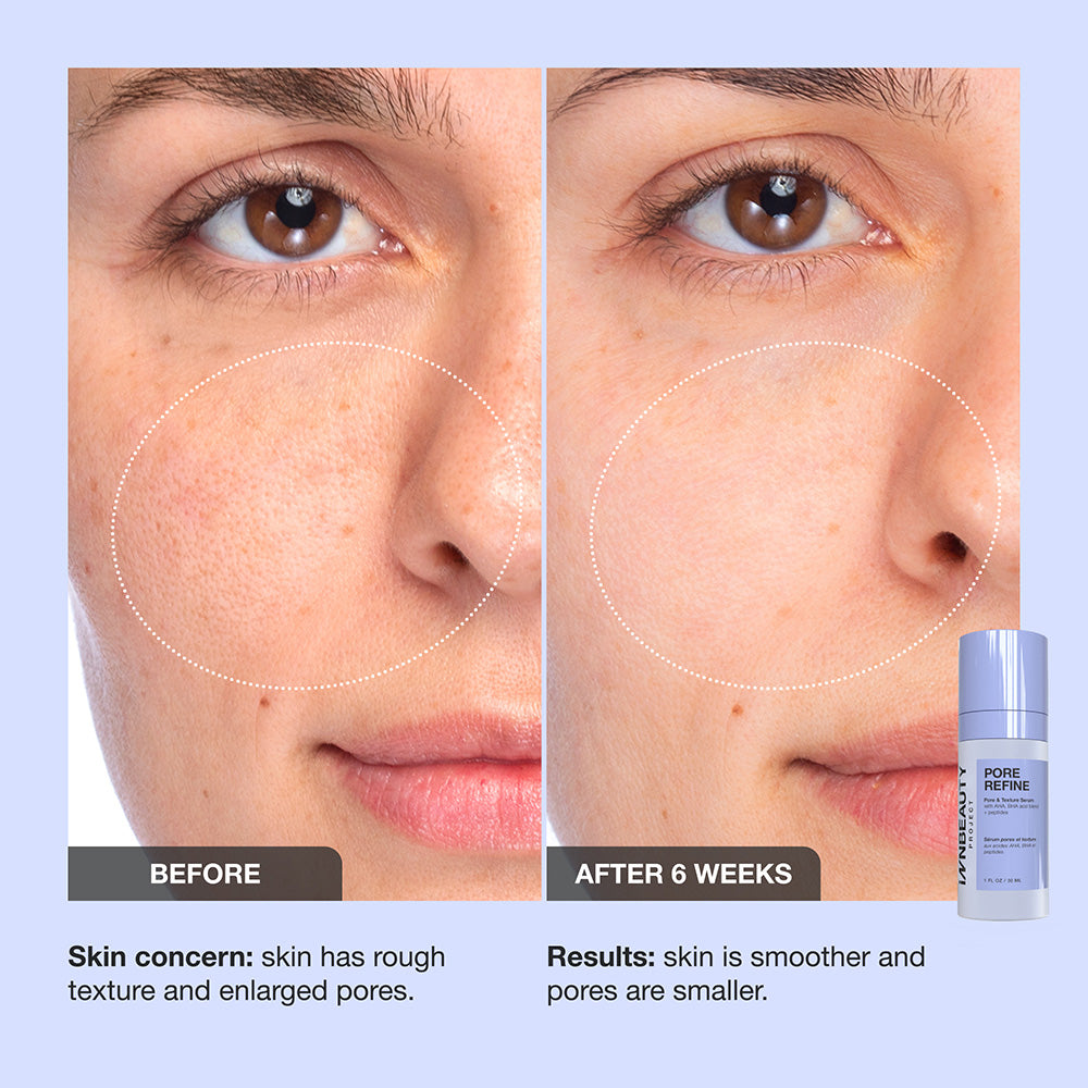 Pore Refine