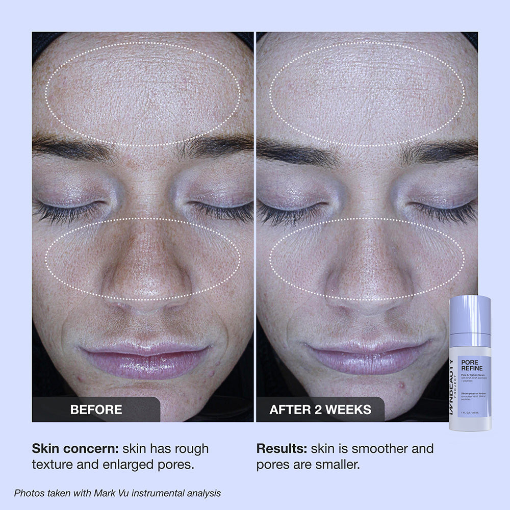 Pore Refine