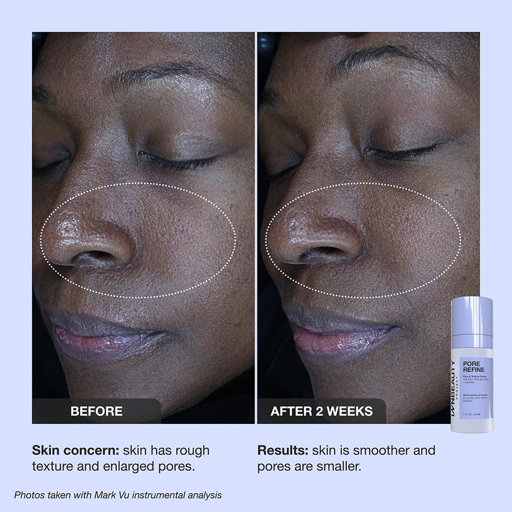 Pore Refine