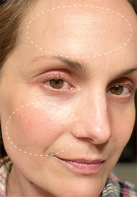 Retinol Remix 1% Retinol after