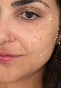 Retinol Remix 1% Retinol before and after images