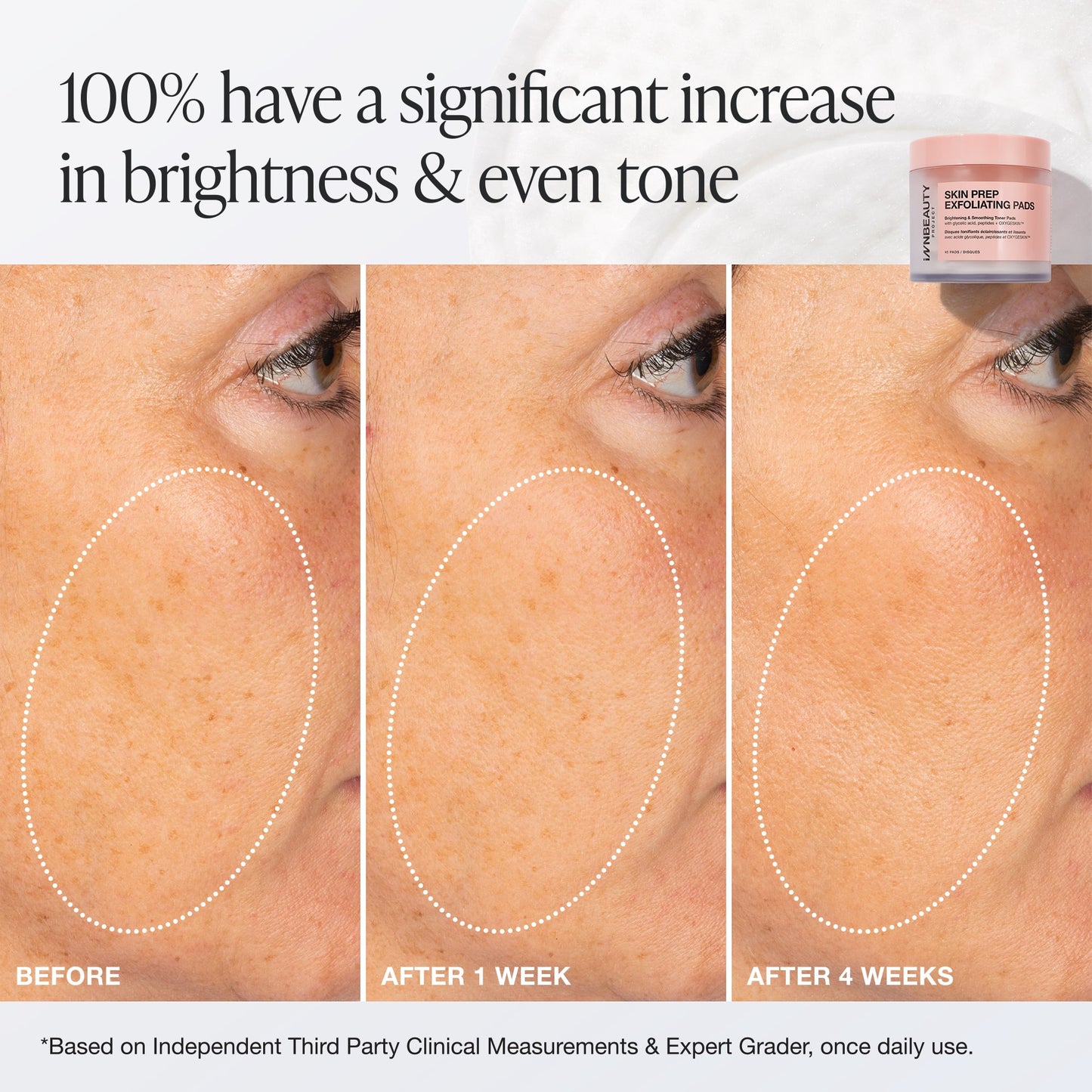 Skin Prep Exfoliating Pads