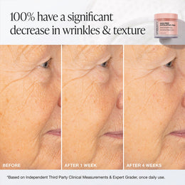 Skin Prep Exfoliating Pads | Brightening Pads for Smooth Skin ...