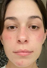Slushy before and after images