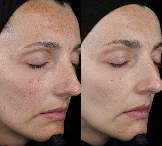 Pro C Serum Refill Set | Vitamin C Brightening Serum Duo