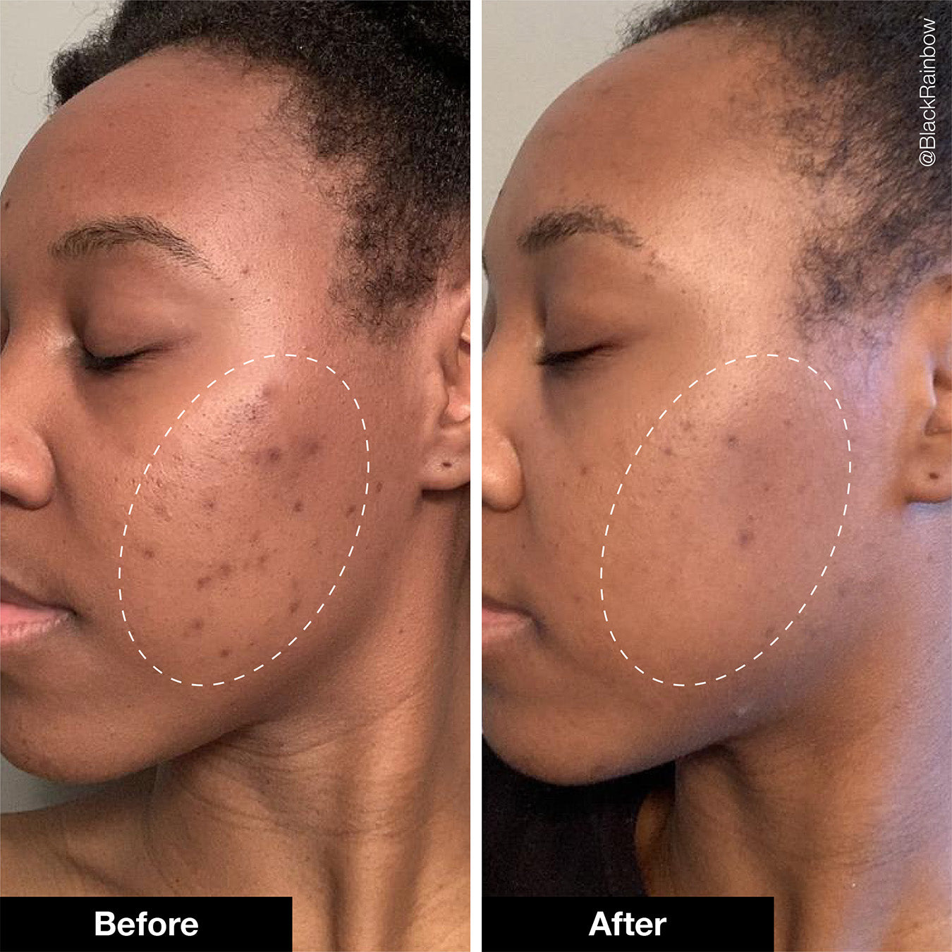 Retinol Remix 1% Retinol