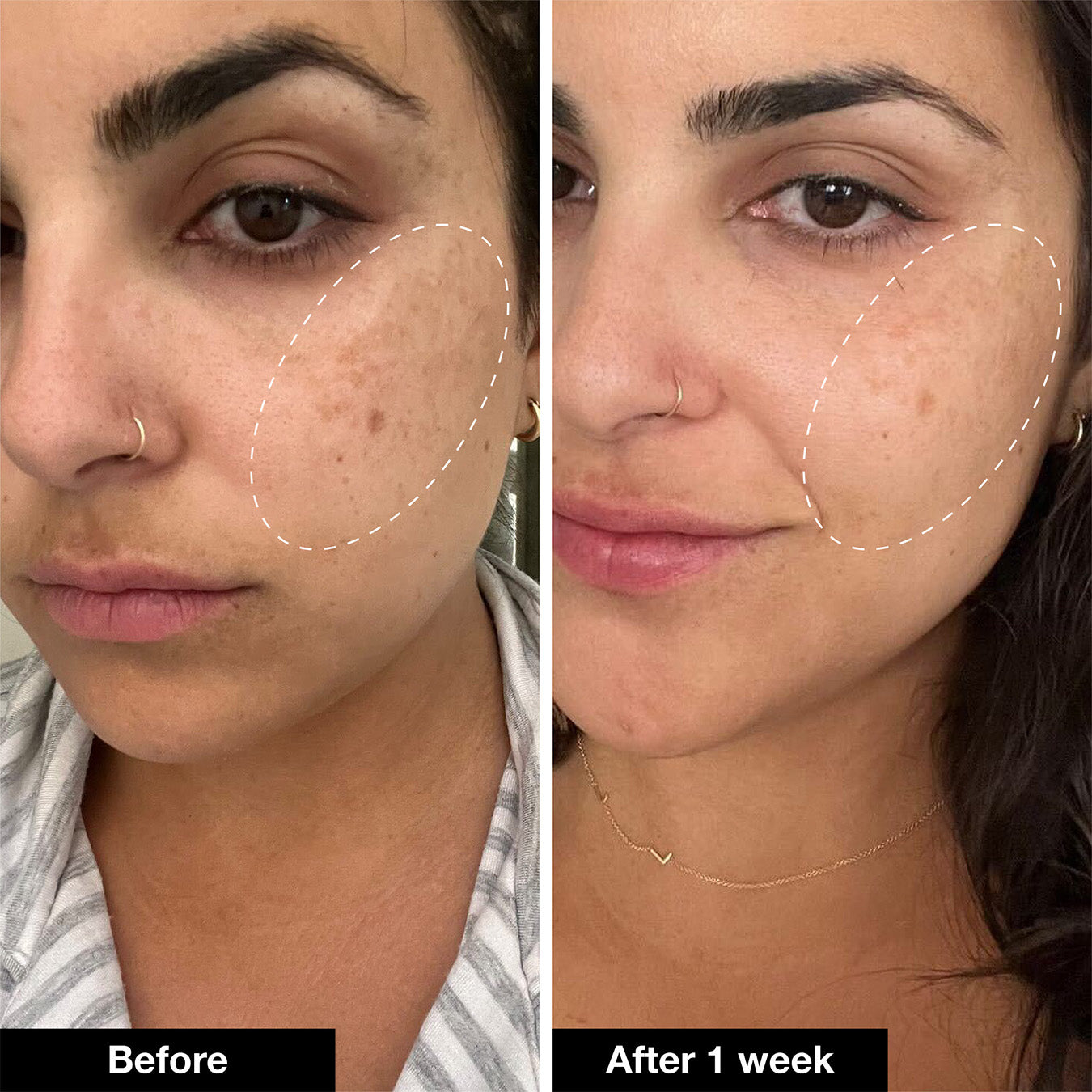 Retinol Remix 1% Retinol