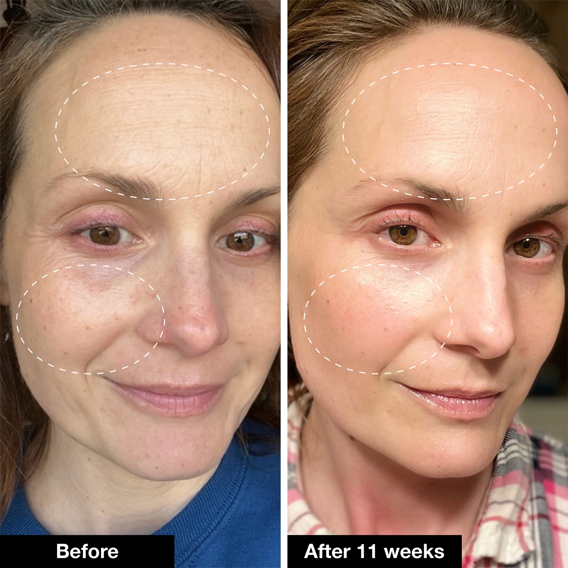 Retinol Remix 1% Retinol – INNBEAUTY PROJECT